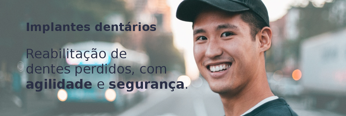 Implantes dentários: Reabilitação de dentes perdidos com segurança e agilidade.